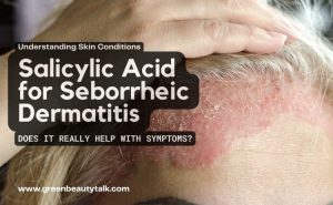 Sobril Rash Salicylic Acid For Seborrheic Dermatitis—Does It Really Help?