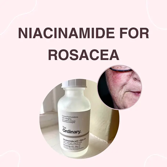 niacinamide for rosacea