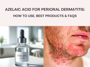 Azelaic Acid For Perioral Dermatitis: Benefits & How To Use