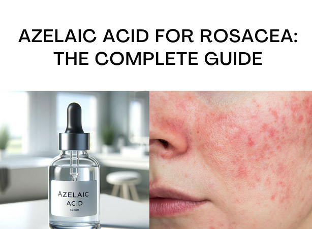 azelaic acid for rosace
