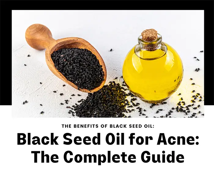 Black seed oil for acne: The complete guide